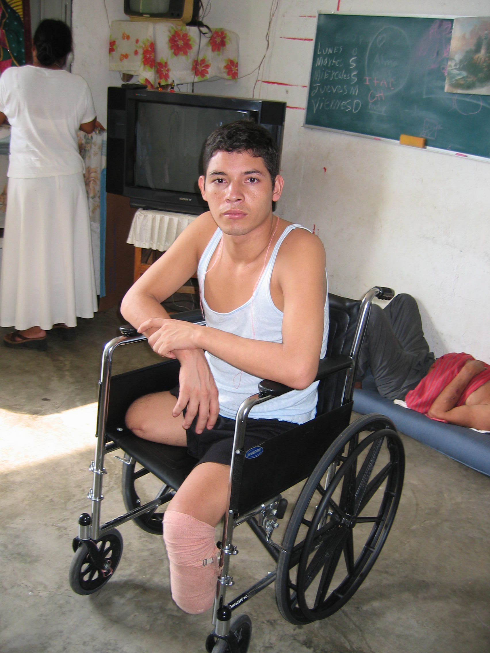 Tránsito Encarnación Martínes Hernández, from Honduras, lost part of both legs to a train.
